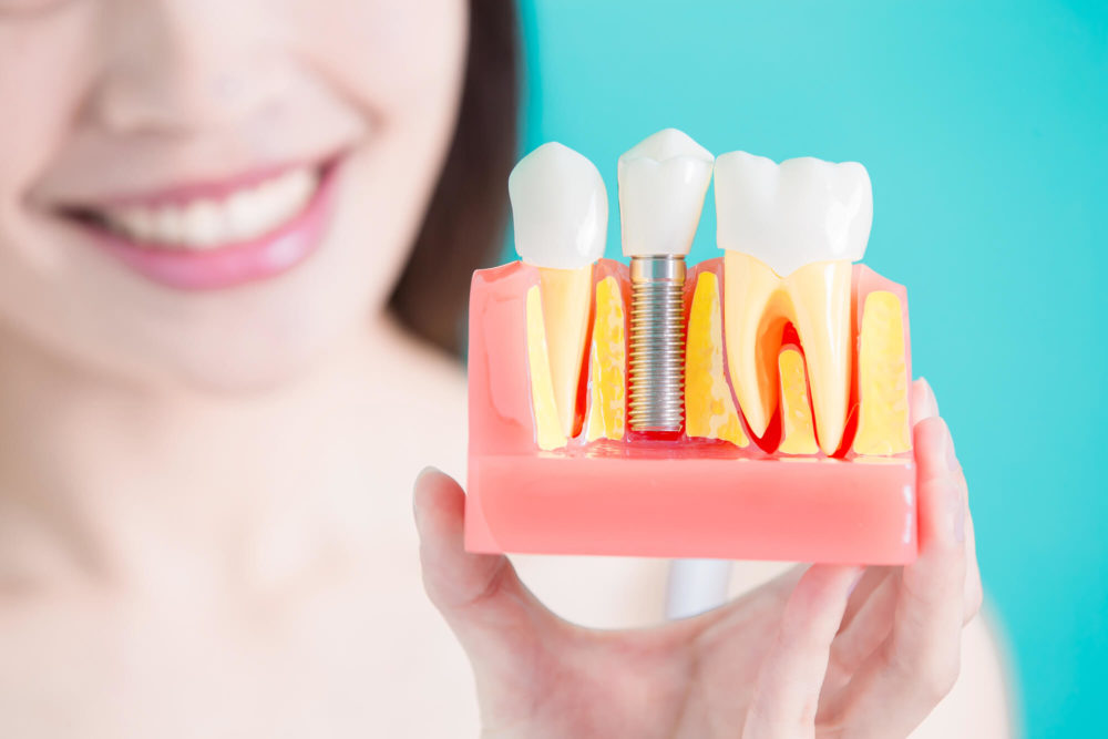 Deep Teeth Cleaning Recovery Tips (How To Heal Fast) 