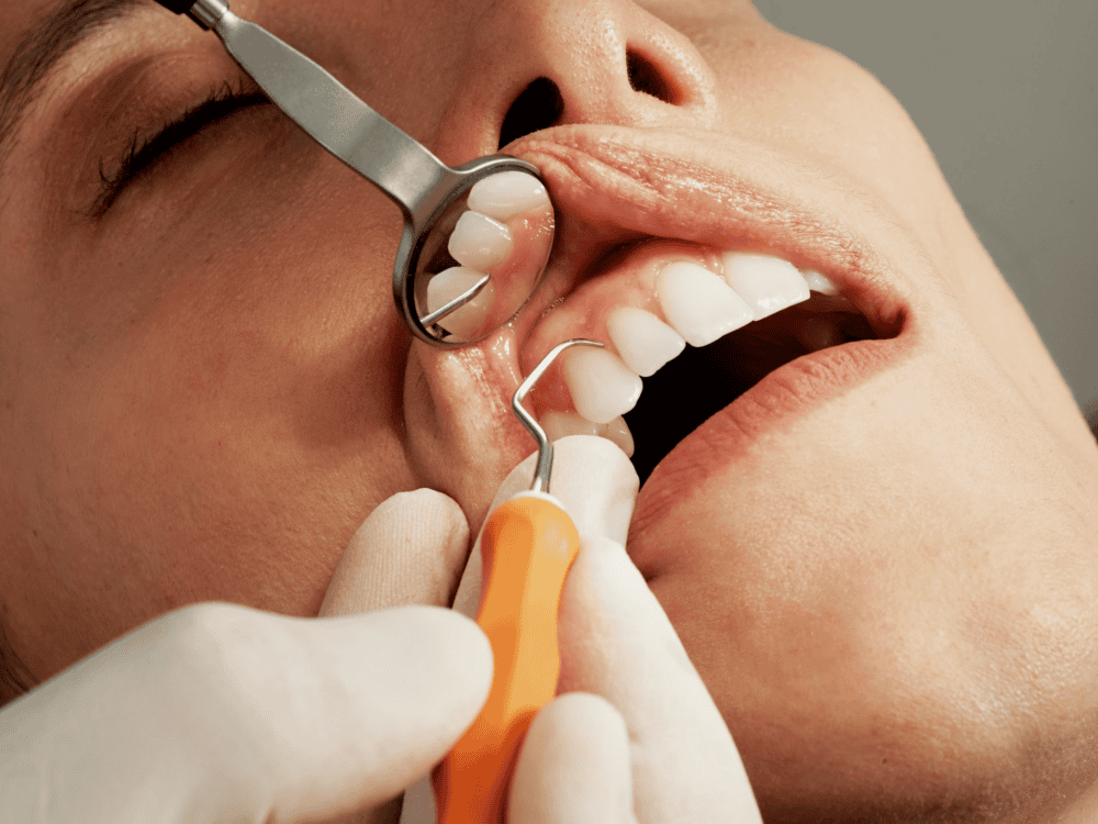 Woman Undergoing Deep Teeth Cleaning Procedure